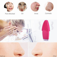 Carregar imagem no visualizador da galeria, LIMPADOR DE POROS FACIAL ELÉTRICO